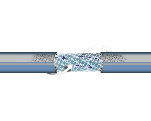 Buizenreparatie met manchet